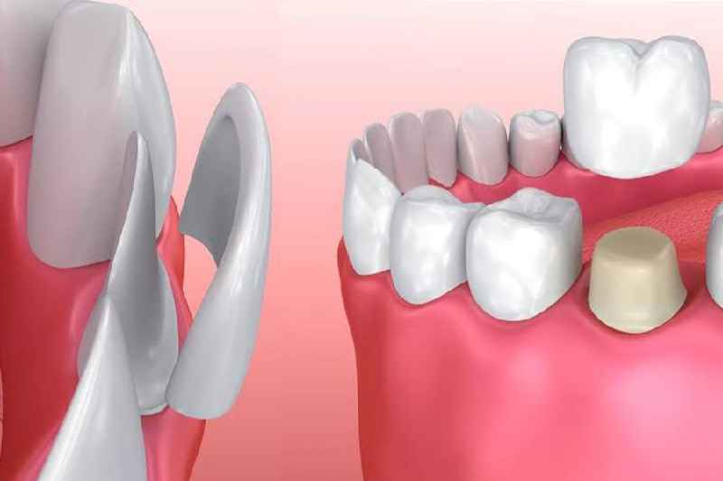 What is the difference between a cosmetic dentist and a prosthodontist