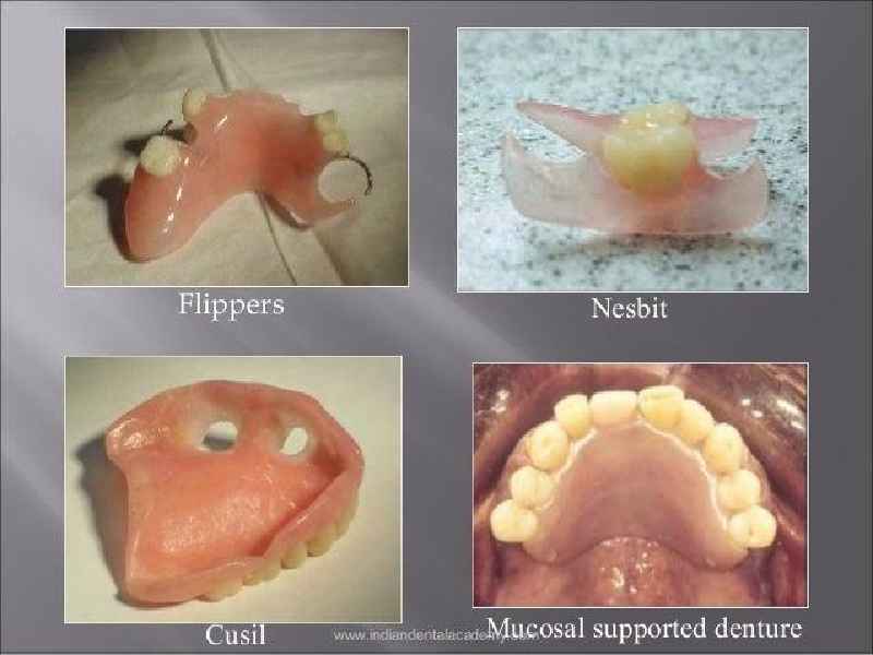 What is the difference between a flipper and a denture