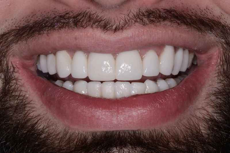 What is the meaning of cosmetic dentistry
