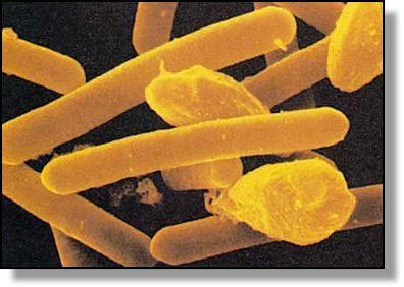 What is the most common form of botulism