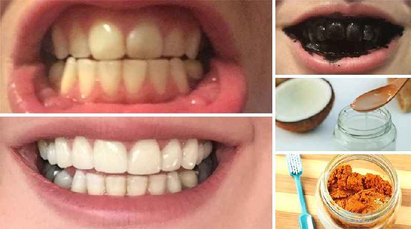 What is the most effective whitening ingredient