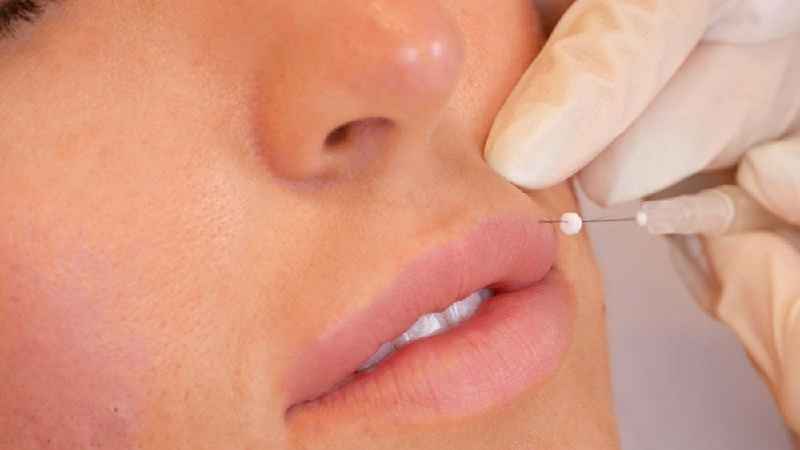 What is the newest skin tightening procedure
