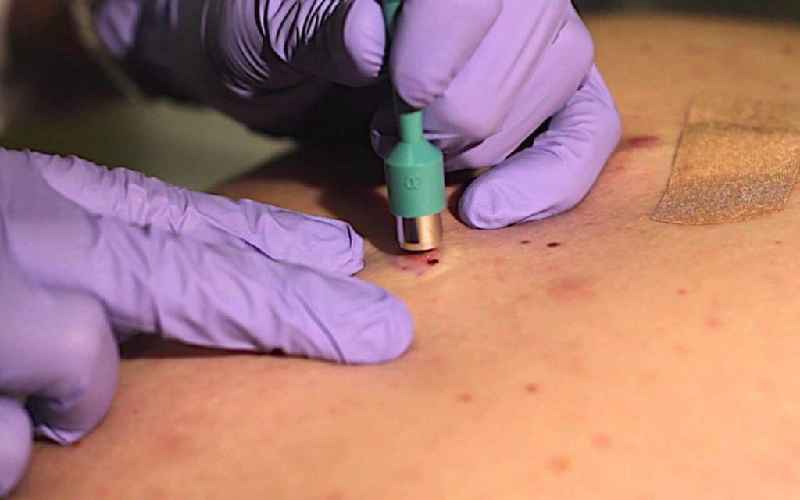 What is the procedure for a skin biopsy