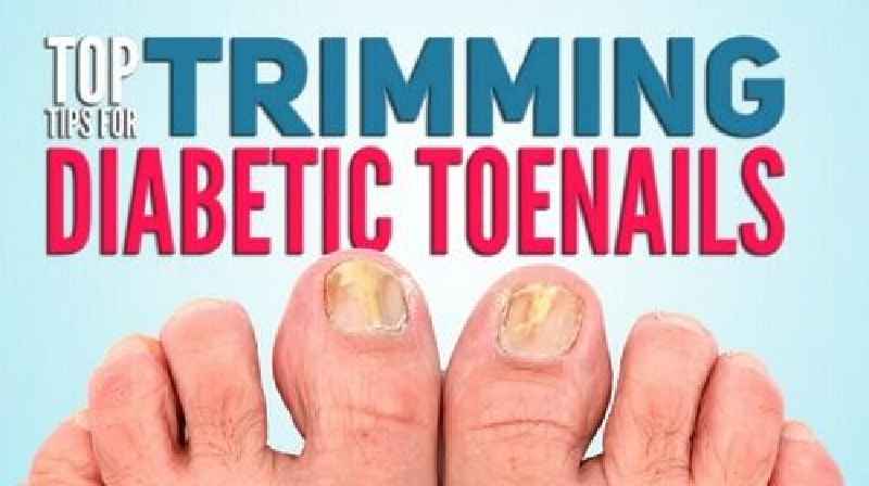 What is the risk of trimming nails of diabetic patients