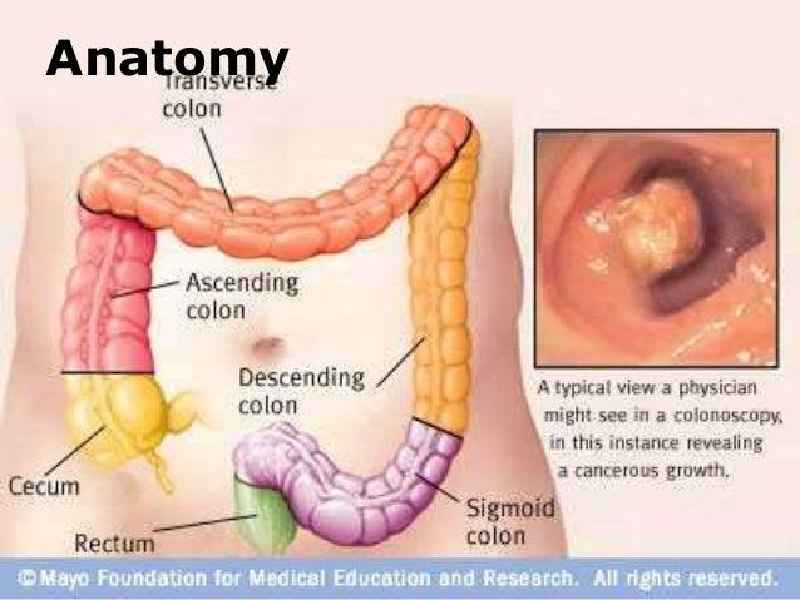 What is the root operation for colonoscopy with polypectomy