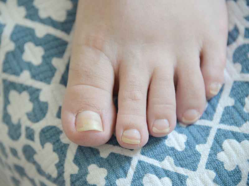 What is the white stuff under my toenails