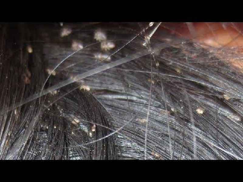 What is Type 3a hair