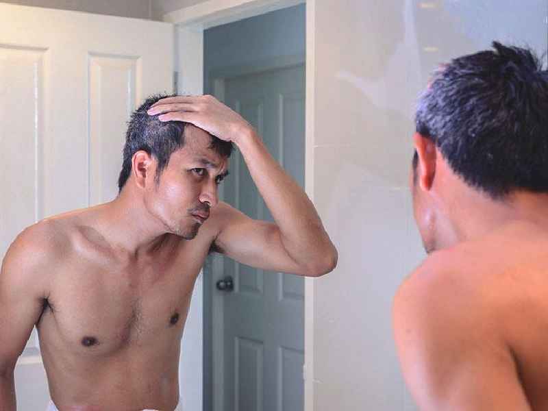 What medical condition makes you lose your hair