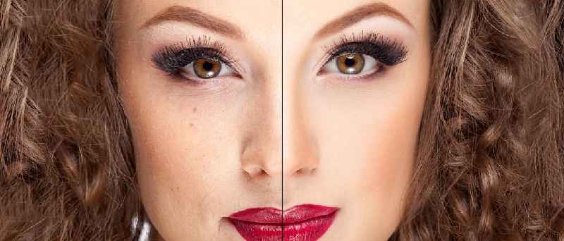 What percentage of plastic surgery is cosmetic