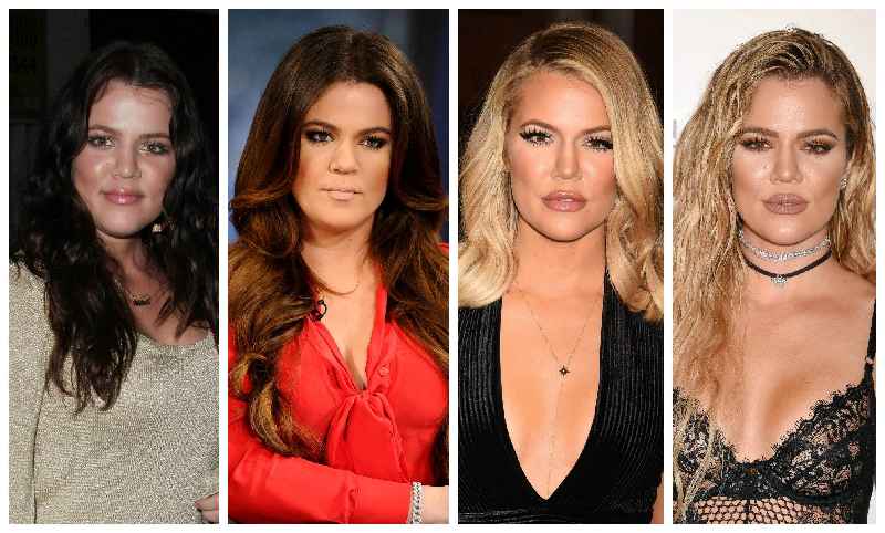 What plastic surgeries have the Kardashians gotten