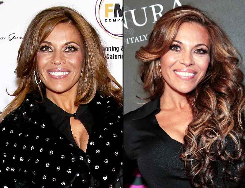 What plastic surgery did Dolores Catania