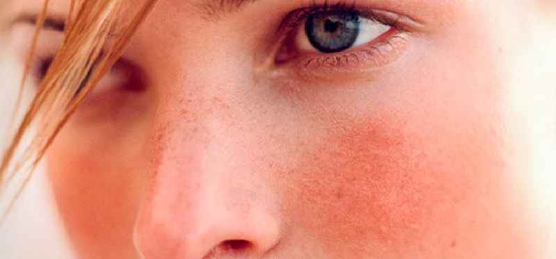 What products make your skin more sensitive to sun