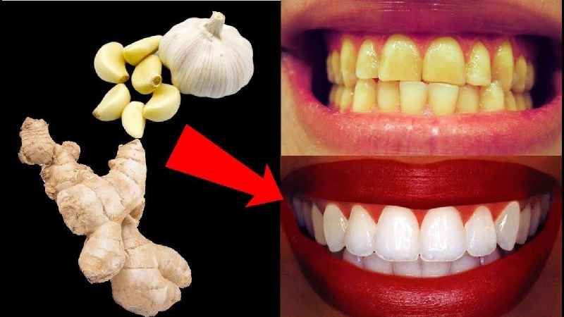 What's best to whiten your teeth