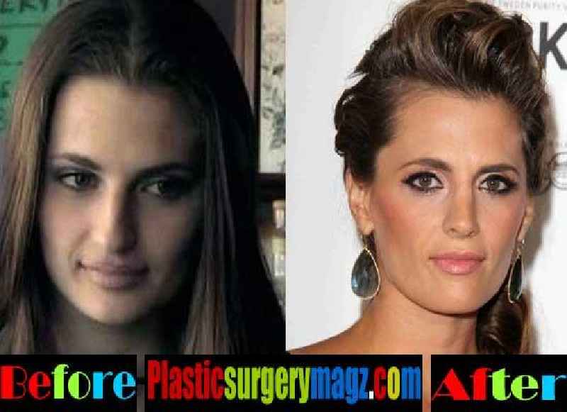 What's the difference between cosmetic surgery and plastic surgery