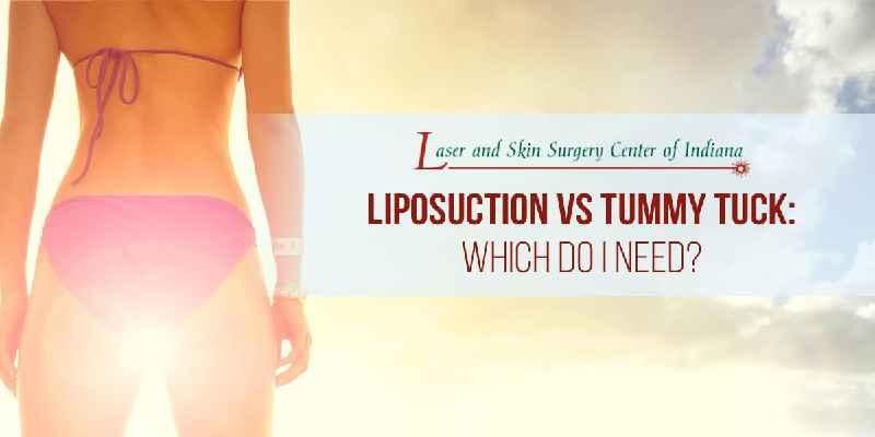 What's the difference between cosmetic surgery and plastic surgery