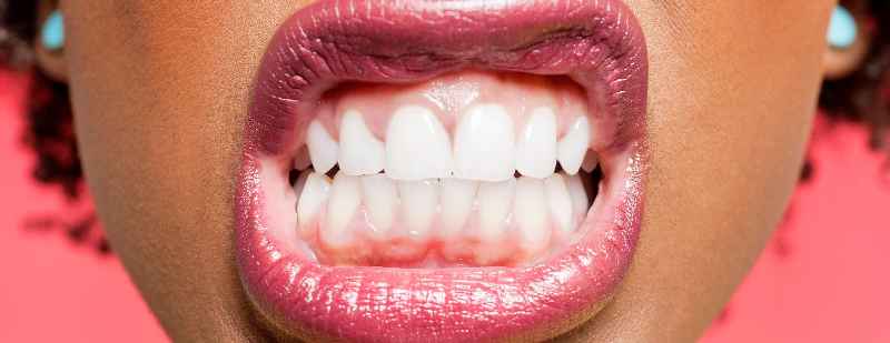 What's the secret to White teeth