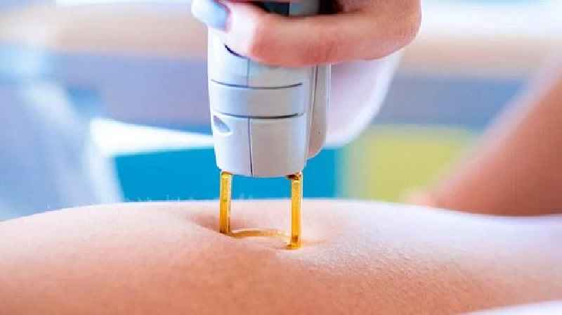 What should I avoid after laser treatment