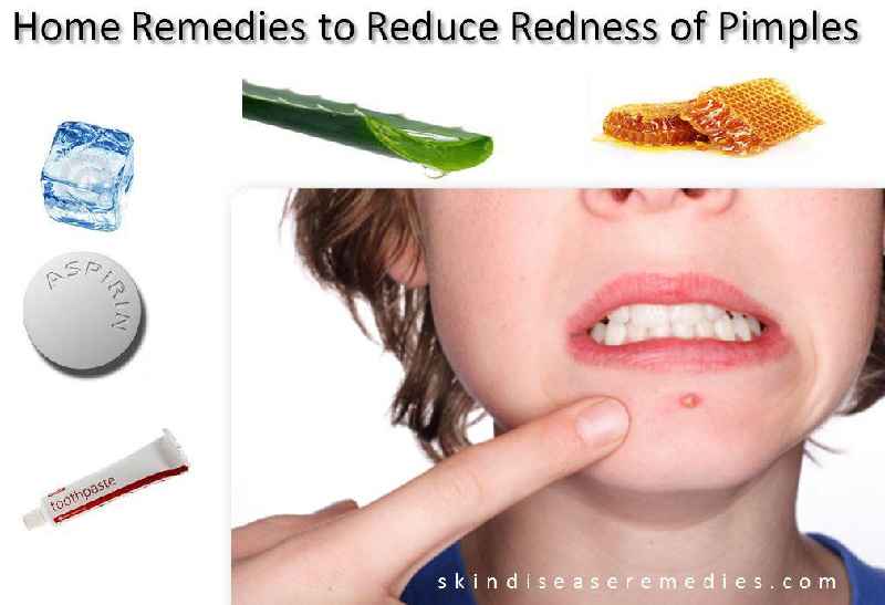 What to drink to reduce pimples