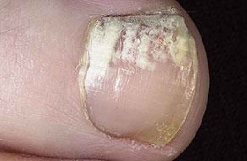 What type of doctor do you see for toenail issues
