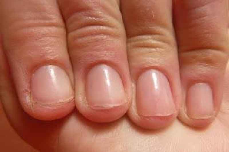 What Vitamin Are you lacking if your nails split