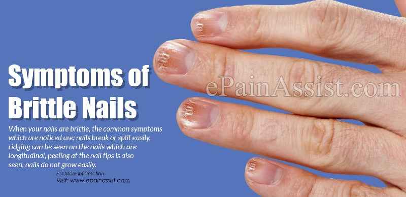 What Vitamin Are you lacking when your nails split