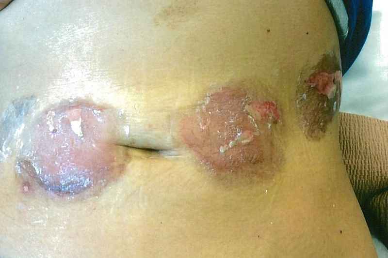 What Vitamin burns the most fat