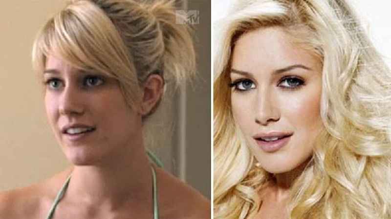What was Heidi Montag's first surgery