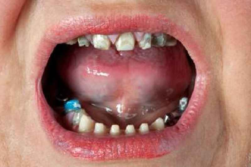 What will happen if you do not take good care of your mouth and teeth