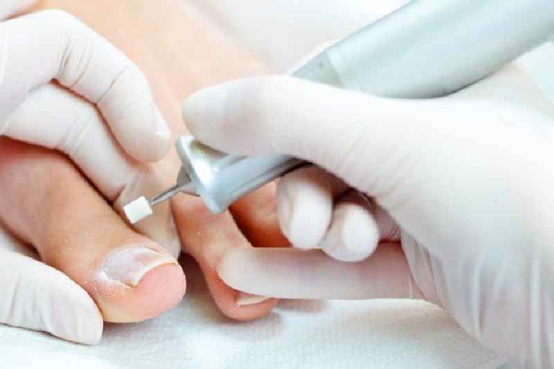 What will happen if you leave an ingrown toenail untreated