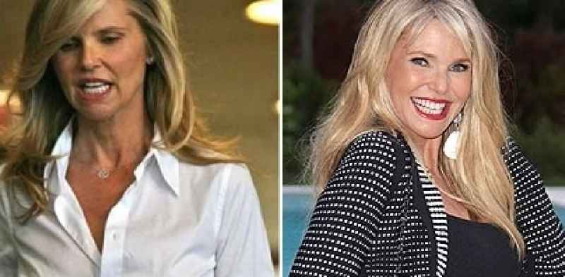 What work has Christie Brinkley done to her face