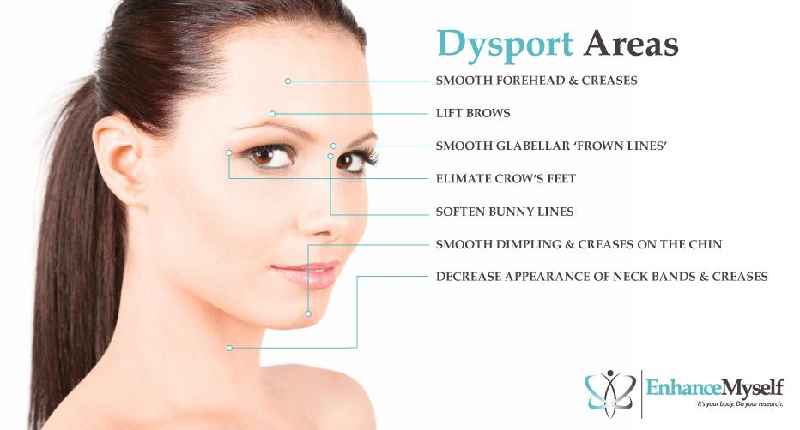 Whats better Botox or Dysport