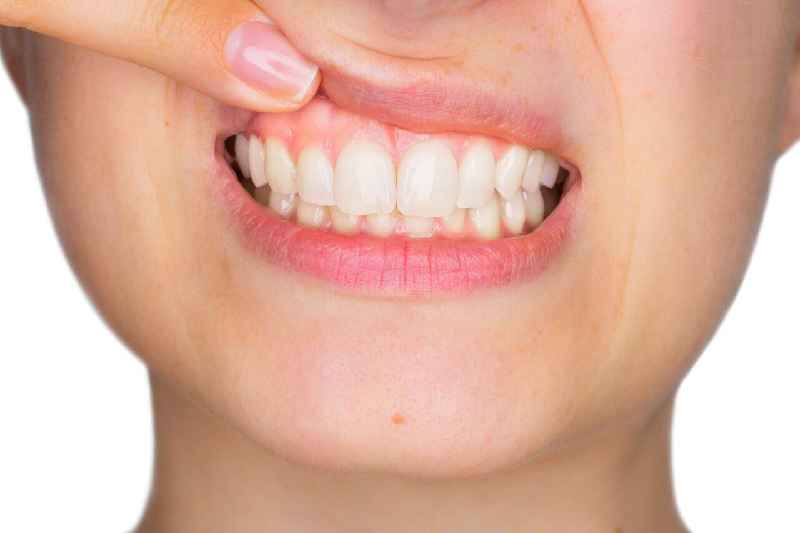 When should you not get dental implants