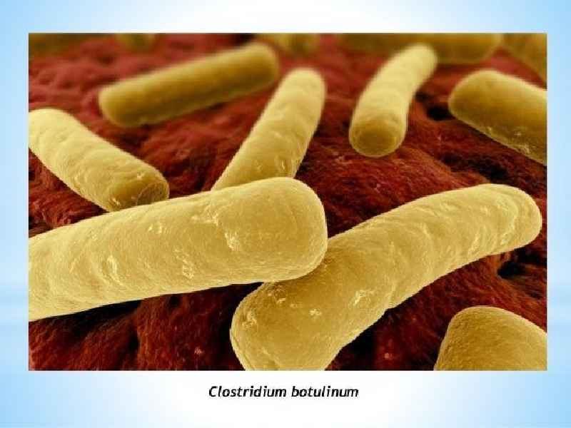 Where is Clostridium botulinum most commonly found