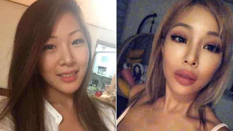 Which country has the best plastic surgery