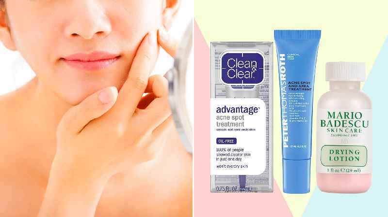 Which cream is best for pimples