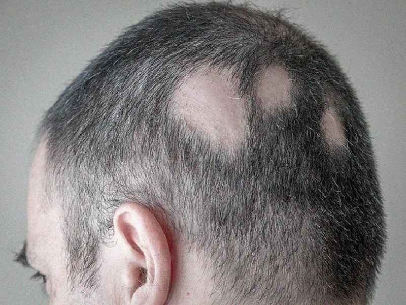 Which doctor treats hair problems
