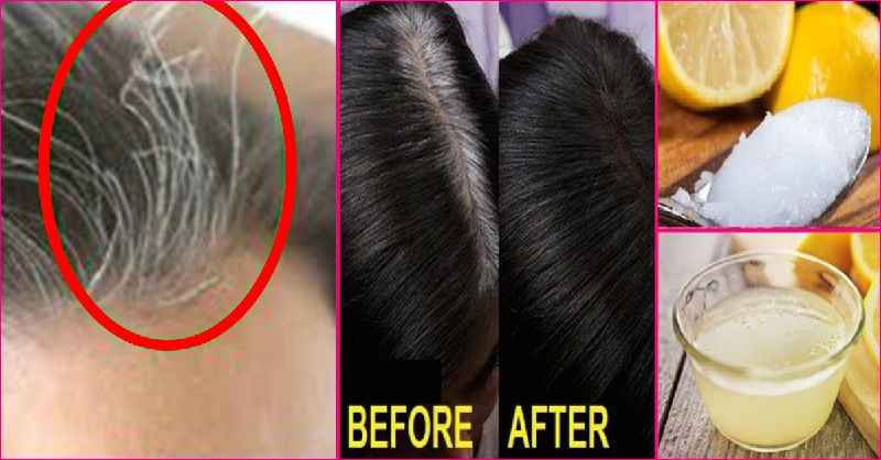 Which food can stop hair fall