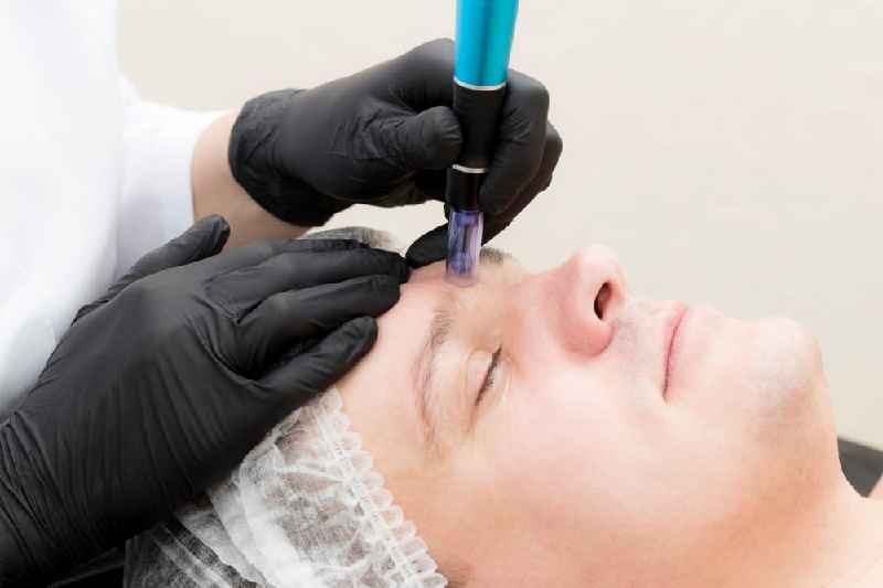 Which is better Botox or microneedling