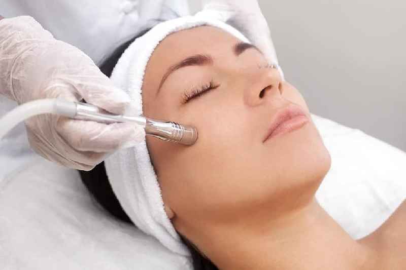 Which is better chemical peel or microdermabrasion