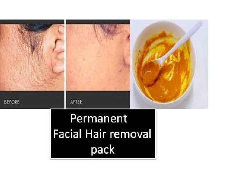 Which method removes hair permanently