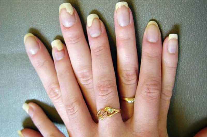 Which nail polish does not damage nails