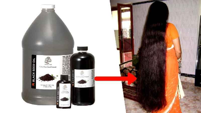 Which oil is best for hair growth