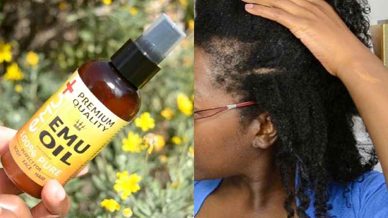Which oil is best for postpartum hair loss