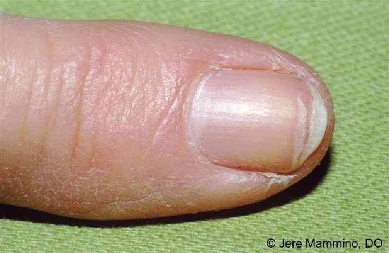 Which vitamin makes nails stronger