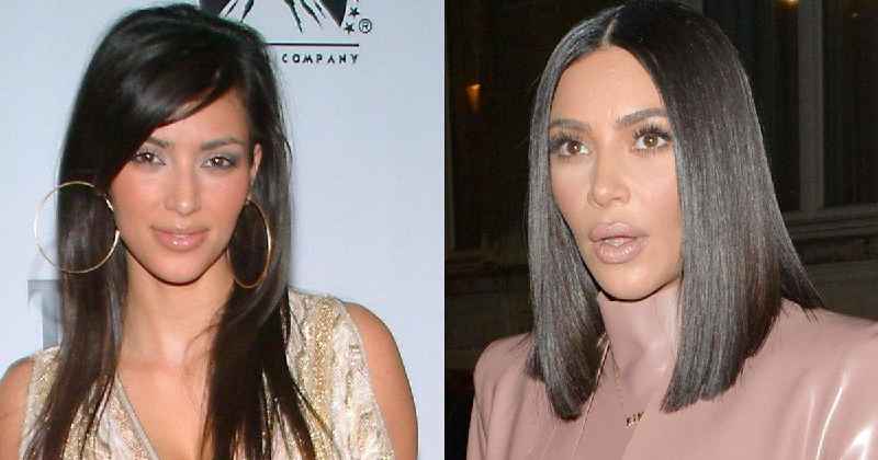 Who is the Kardashian plastic surgeon