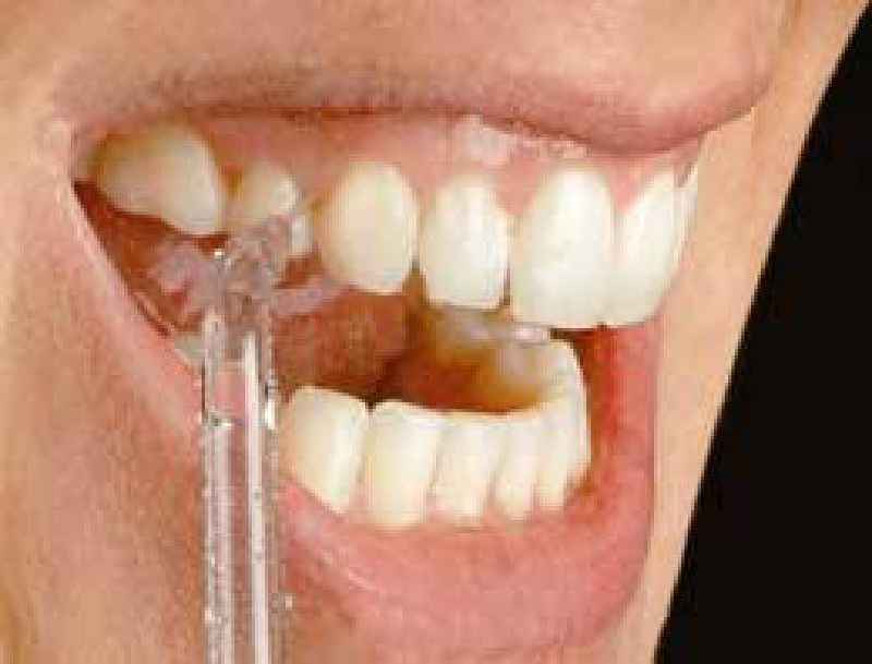 Why do dental hygienists make so much