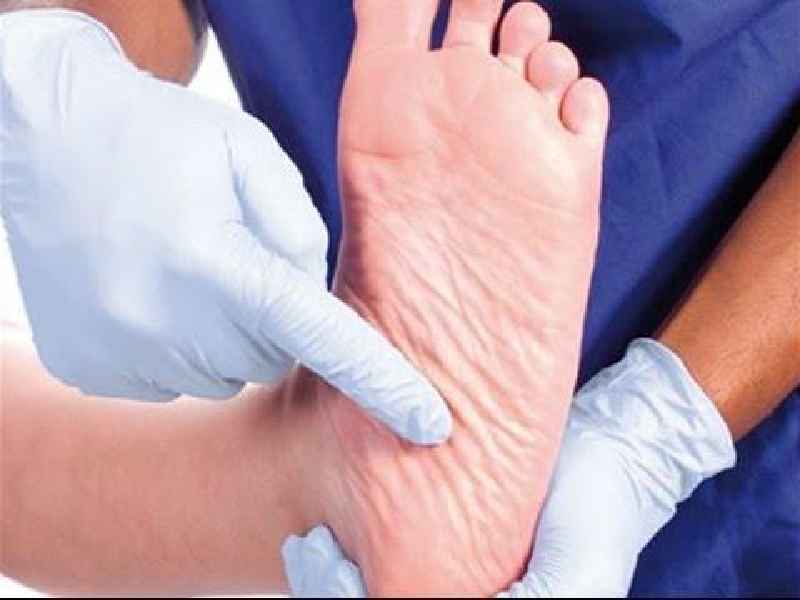 Why do diabetics feet swell
