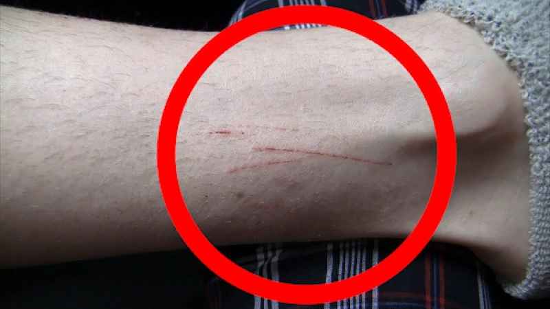 Why do scratch marks appear
