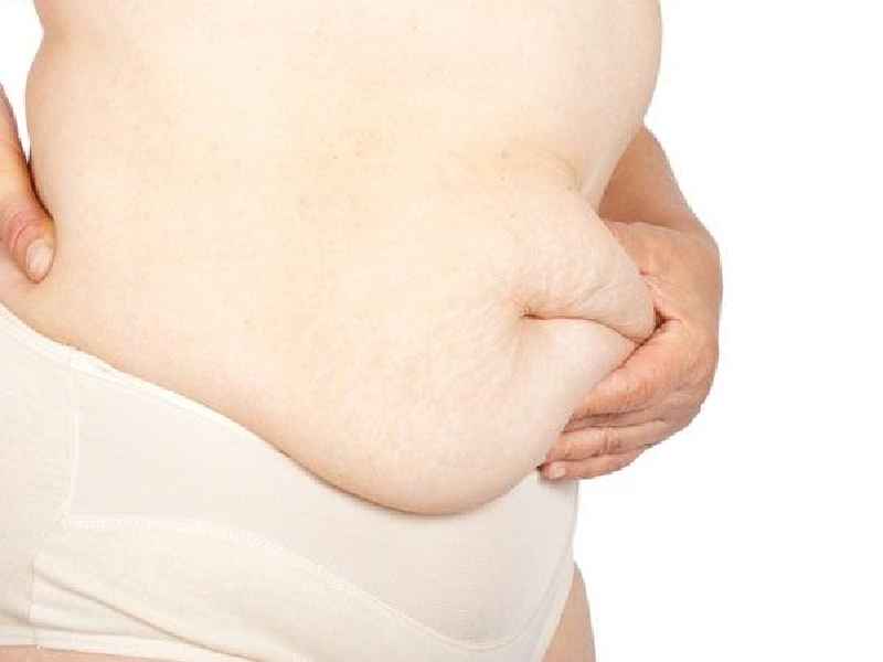 Why do stalls happen after gastric sleeve