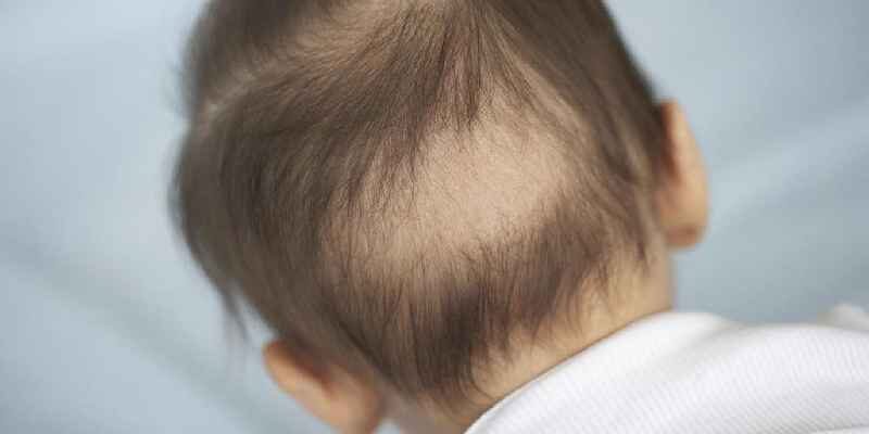 Why do you lose hair postpartum